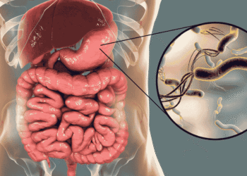 نوجوان مریض اسپتال میں کینسر کے علاج کے دوران — معدے اور آنتوں کے کینسر میں اضافہ