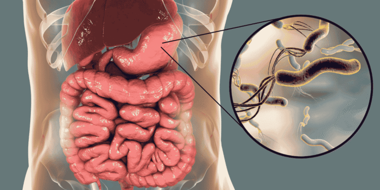 نوجوان مریض اسپتال میں کینسر کے علاج کے دوران — معدے اور آنتوں کے کینسر میں اضافہ