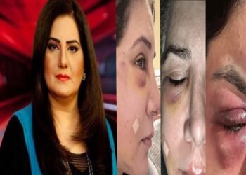 جیسمین منظور کی شیئر کردہ تصویر، آنکھ پر سوجن کے ساتھ