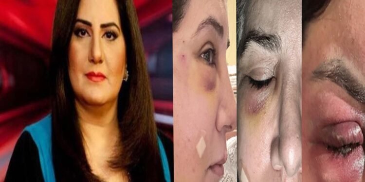 جیسمین منظور کی شیئر کردہ تصویر، آنکھ پر سوجن کے ساتھ