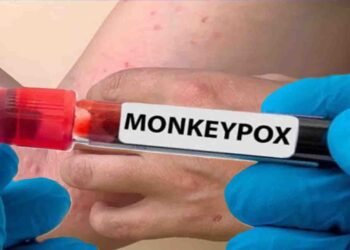 اسلام آباد میں خلیجی ملک سے آنے والے شہری میں منکی پاکس کیس کی تصدیق