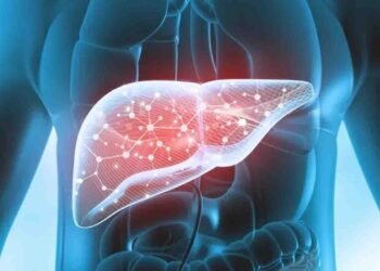 جگر پر چربی