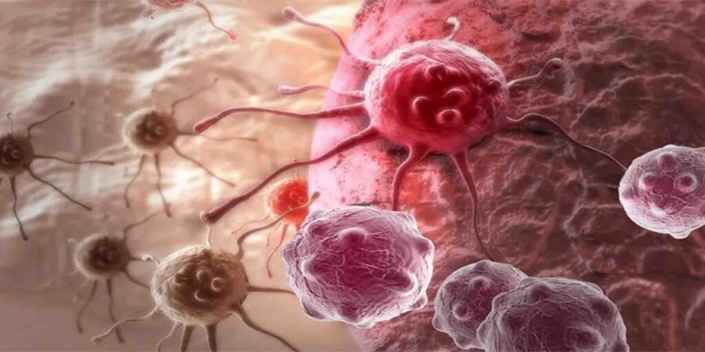 کینسر سے بچاؤ کے لیے تیز چہل قدمی کی عادت