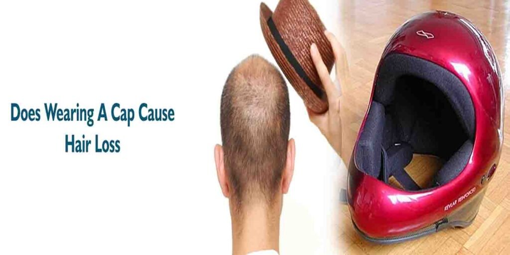 کیا ہیلمٹ یا ٹوپی بال گرنے کی وجہ ہے؟