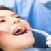 دانتوں کی فلنگ کا متبادل جیل — دانتوں کی سطح کی بحالی